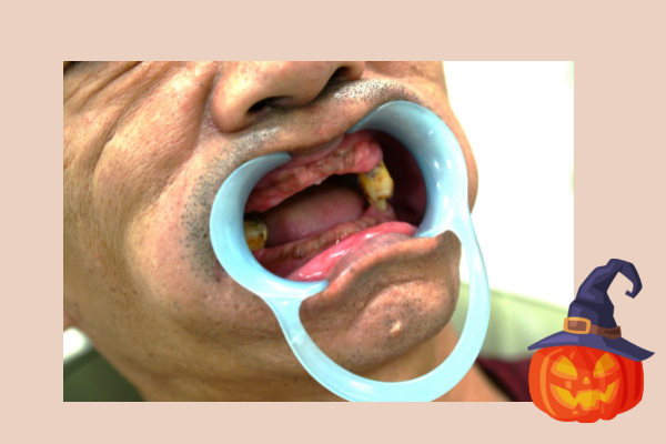 [心得] 專業全口重建-朱裕華醫師|健康的嘴巴 健康的生活-